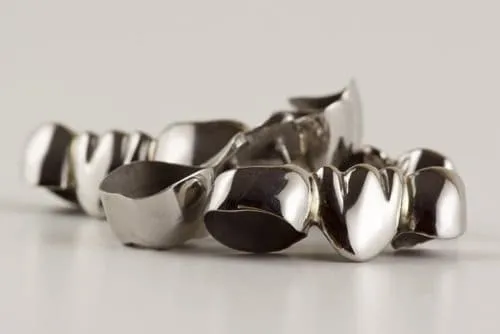 Hochwertige Brücken aus unserem Dentallabor