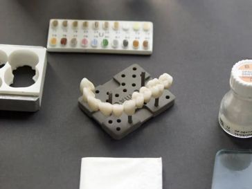 Kronen und Brücken aus unserem Dentallabor in Minden